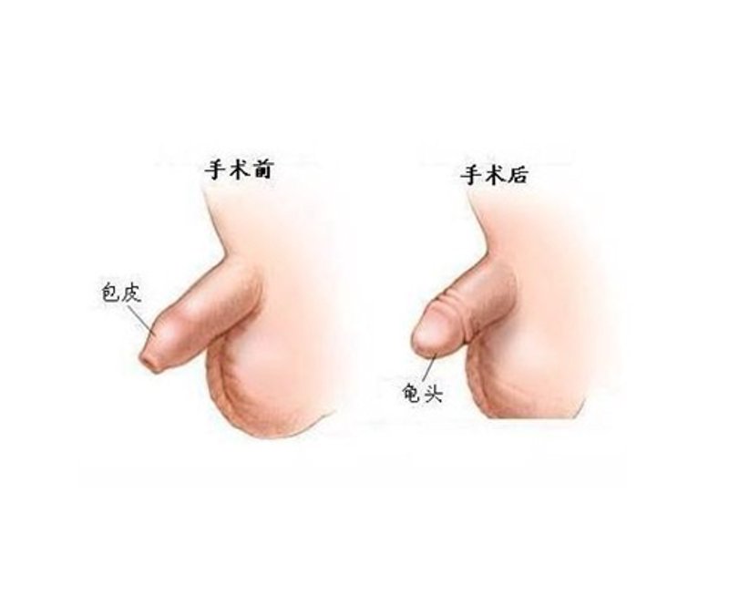 厦门出入境检验检疫局:守护厦门口岸安全的坚实屏障